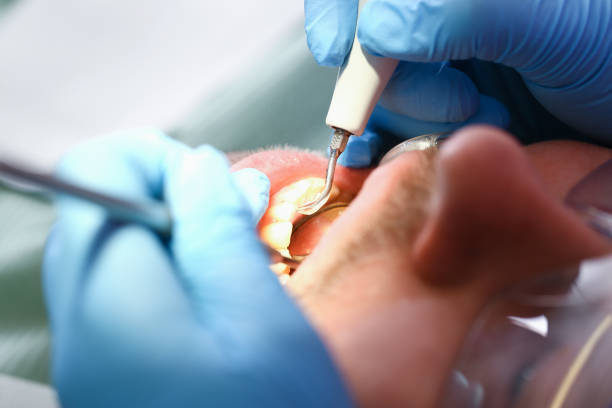 Best Emergency Dental Care for Broken or Chipped Teeth in Fairchild Af, WA